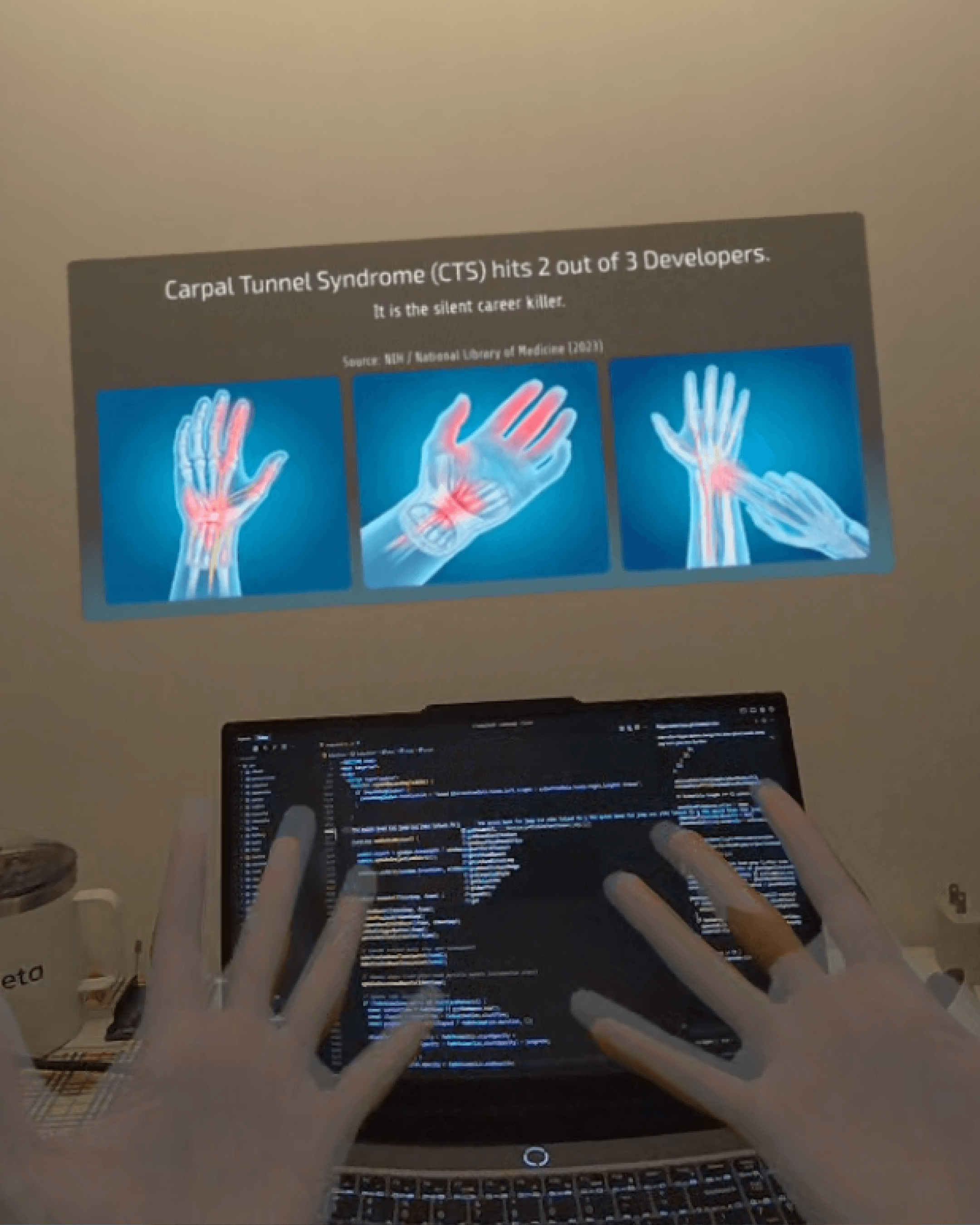 WebXR Spatial Therapy Experience "ZenHands" media